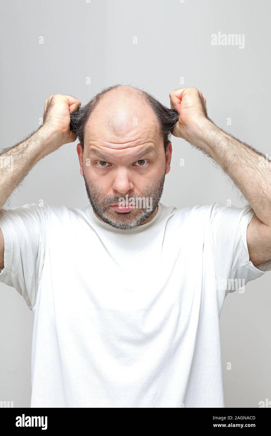La mezza età uomo tira i capelli calvizie problema Foto Stock La mezza età uomo tira i capelli calvizie problema Foto Stock