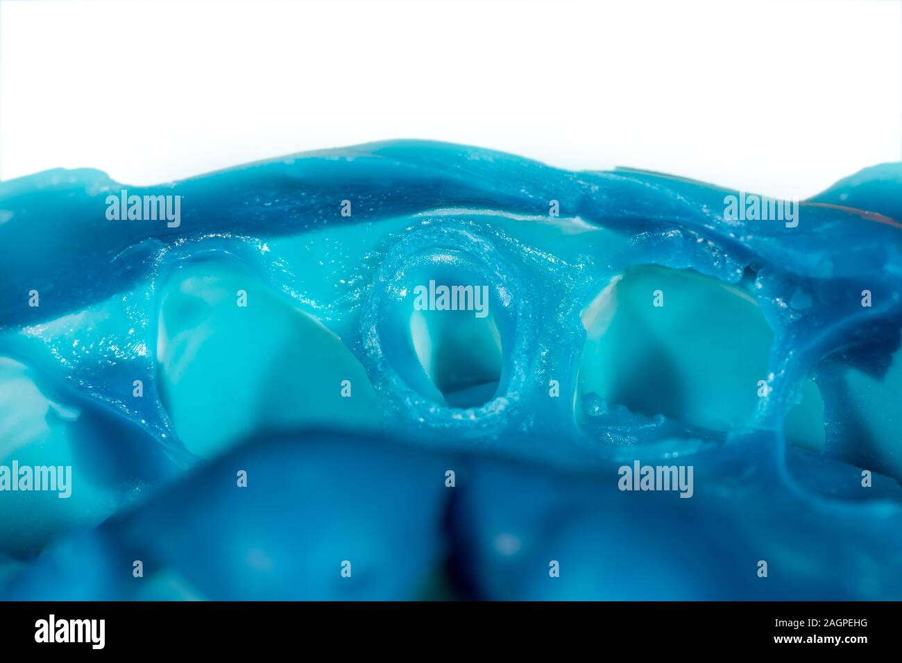 Impronta del dente umano close-up macro. Battuta gengivale. Preparazione di impiallacciature Foto Stock