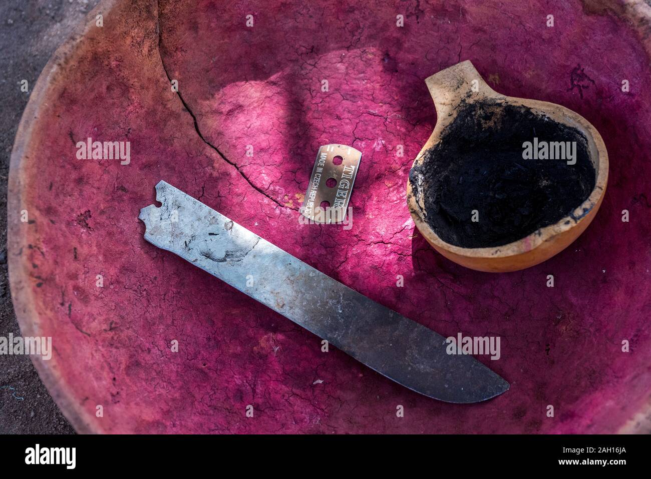 La mutilazione genitale femminile, Benin, Kandi, lama di rasoio, antisettico per incollare, strumenti per perfoming MGF, Foto Stock