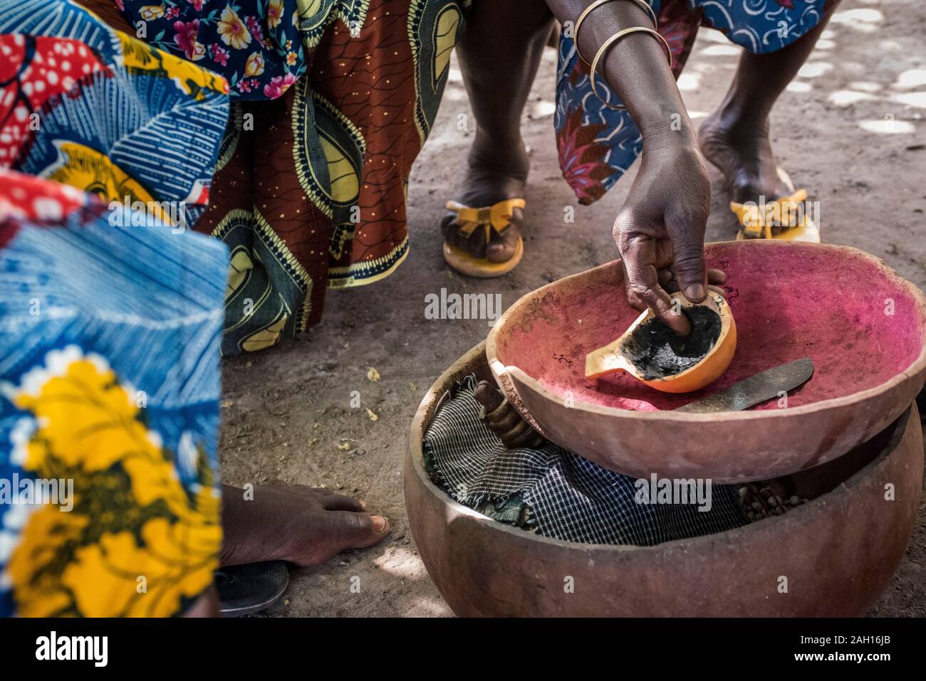 La mutilazione genitale femminile, Benin, Kandi, lama di rasoio,  antisettico per incollare, strumenti per perfoming MGF Foto stock - Alamy