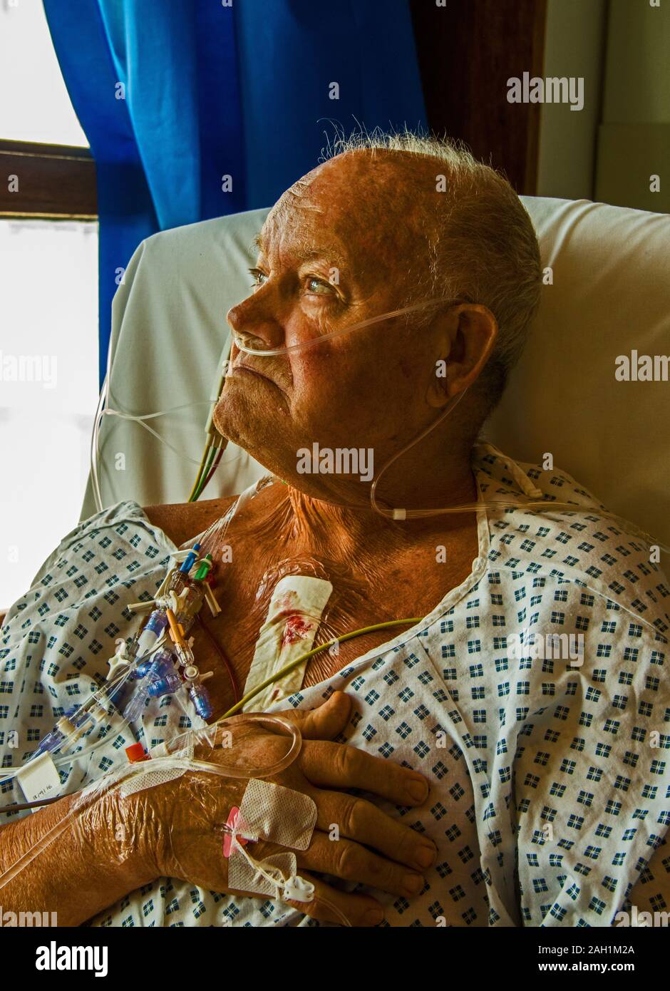 Cuore del paziente di bypass Foto Stock