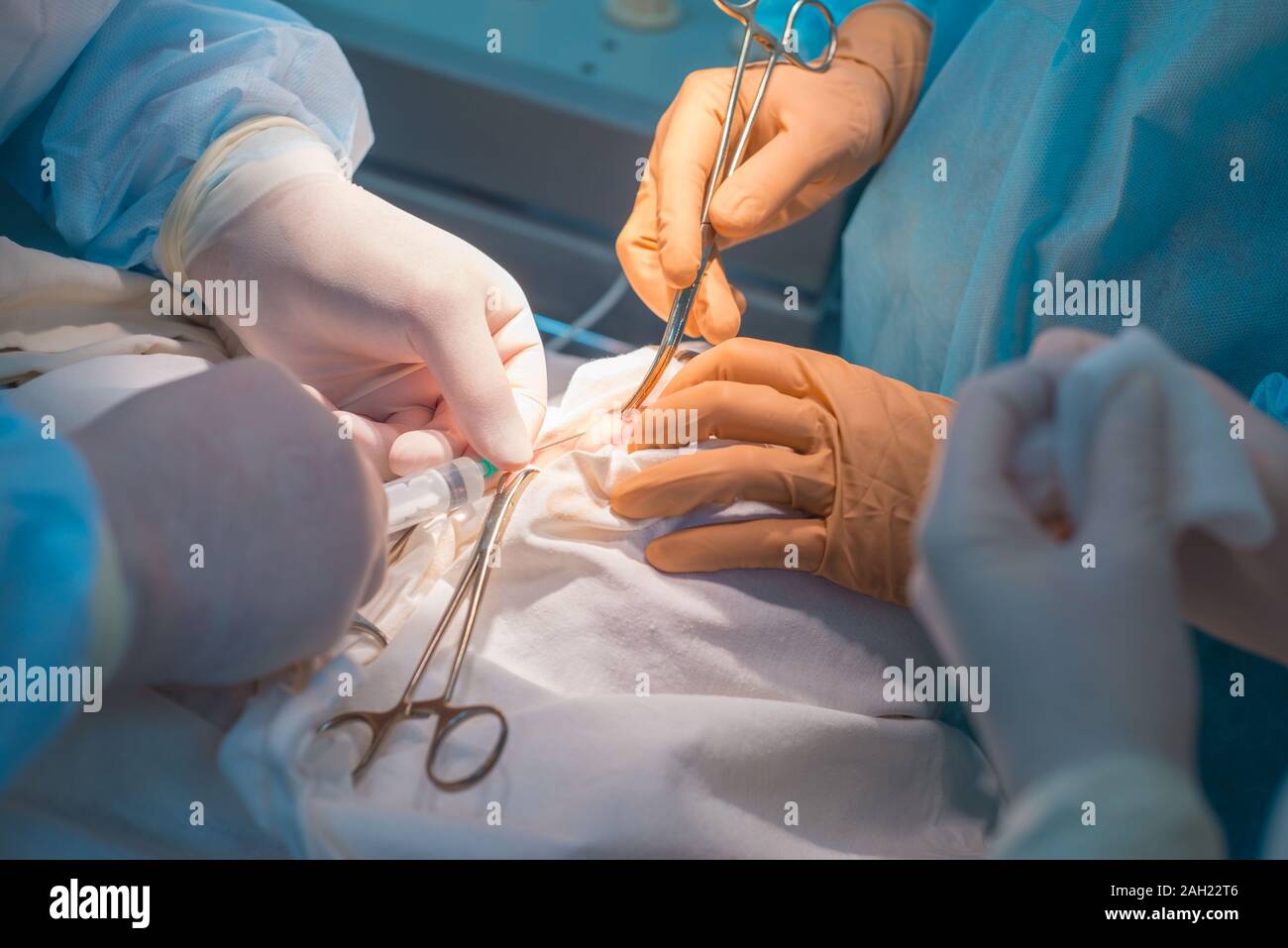 Close-up - un team di chirurghi pediatrici eseguendo una operazione di linfoadenite orecchio. Gli oncologi eseguire una foratura per la diagnosi. Oncolog maligni Foto Stock