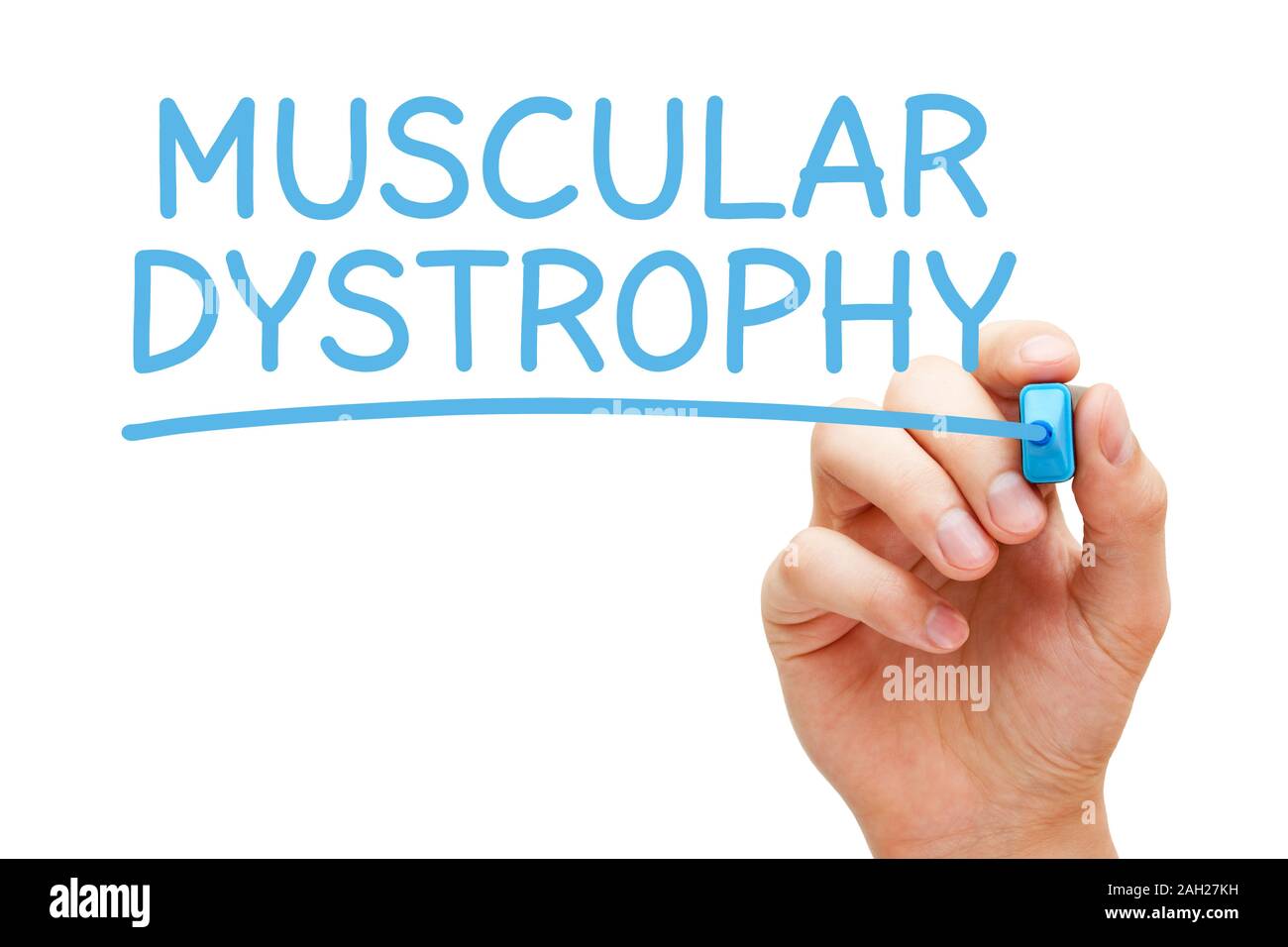 La scrittura a mano la distrofia muscolare con marcatore blu su trasparente wipe board isolati su sfondo bianco. Foto Stock