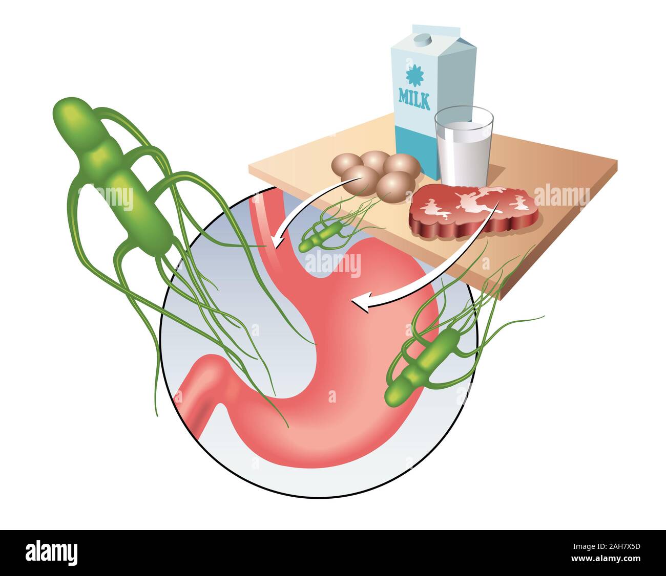 Medical illustrazione che mostra il virus di salmonella e i principali alimenti contaminati. Foto Stock