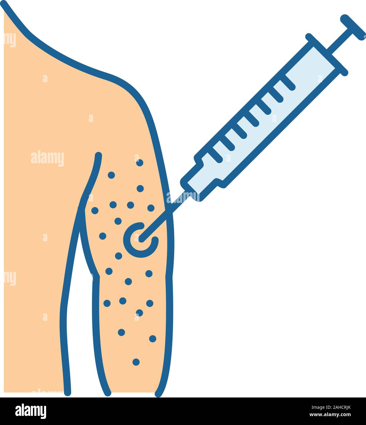 Allergia vaccino icona di colore. Iniezione di vaccinazione. Siringa in  braccio. Consumo di stupefacenti per via parenterale. Rash cutaneo,  irritazione. Isolato illustrazione vettoriale Immagine e Vettoriale - Alamy