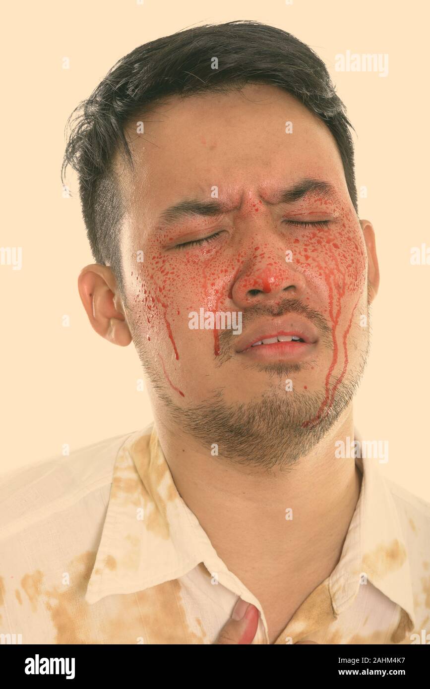 Volto del giovane pazzo uomo asiatico cercando triste con gli occhi chiusi e il sangue sul volto Foto Stock