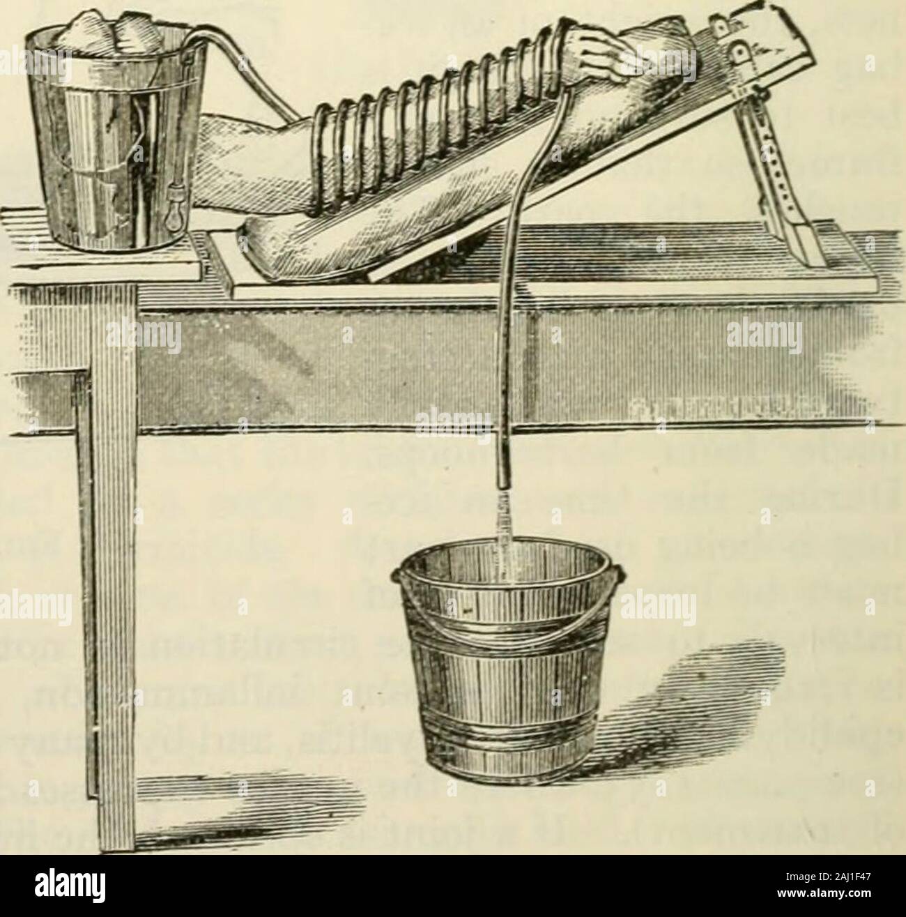 La moderna chirurgia generale e operativo . om-pipistrelli il gonfiore e il dolore ofinflammation. Compressionmust essere giudizioso; deve neverbe energica e non deve beapplied ad un arto senza in cluding la porzione distale dell'estremità (mai, per in-presa di posizione, comprimere fortemente theelbow senza compresi thehand, né il palm withoutbandaging le dita). In compressione giudiziosa causessevere dolore e grande edema,e può produrre una cancrena. Astringenti e Sorbefaci-ents.-astringenti possono havedirect valore nella infiammazione   della pelle, ma esso non è Ukely che hanno qualsiasi ettect su deep-seatedinflam Foto Stock