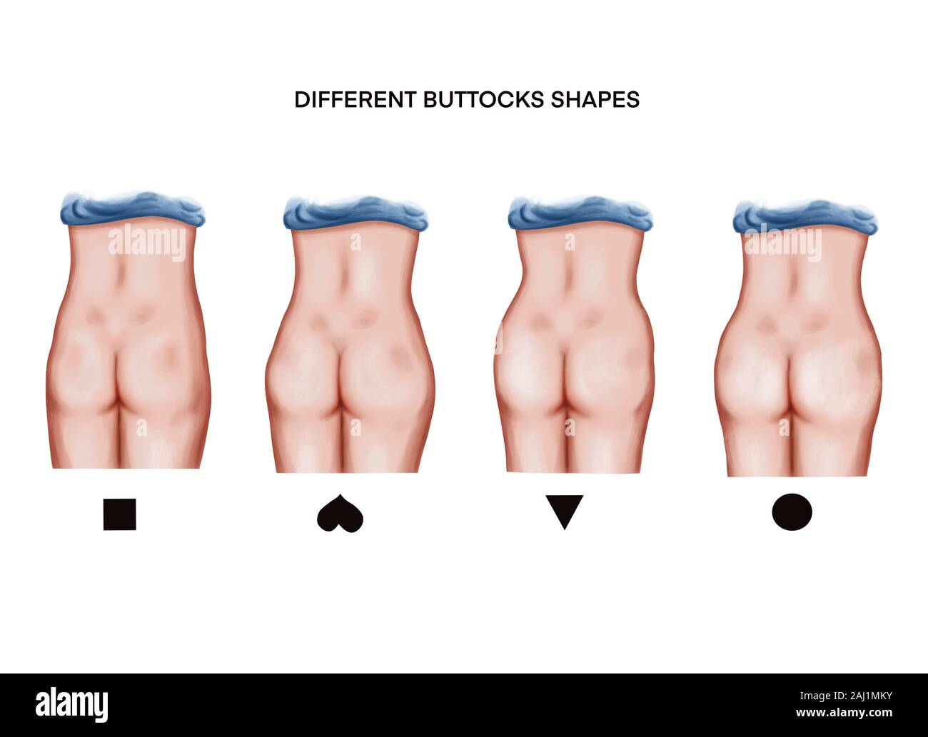 Illustrazione di taut muscoli glutei. prima e dopo i trattamenti o di idoneità Foto Stock