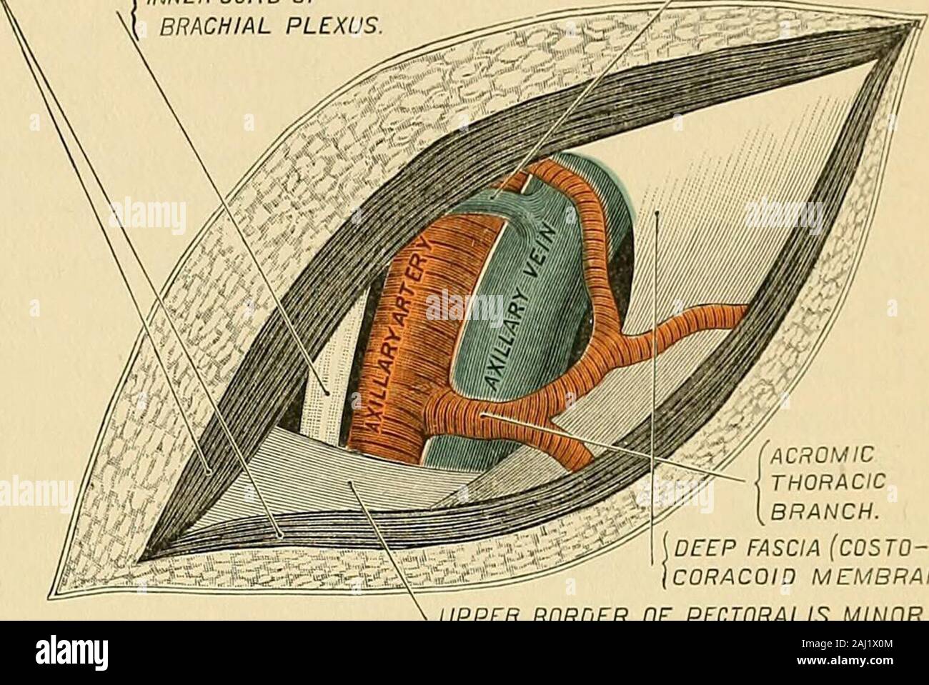 Intervento chirurgico . ^ (prima porzione. ) Vena ascellare. Dietro.primo spazio intercostale e muscoli intercostali.Seconda e terza dentellatura del serratus magnus.posteriore e anteriore interna del nervo toracico. La prima porzione.-Non vi è alcuna guida lineare per la nave a questo por-zione. La guida lineare per il funzionamento si trova a circa mezzo pollice sottole bordo inferiore della clavicola, che si estende dall'interno di un pollice o in modo di thesternal estremità, verso l'esterno tre o quattro pollici. Il muscolare guide sono superficiali e profonde. Il primo è il spacebetween i bordi contigui del muscolo deltoide e pectora Foto Stock