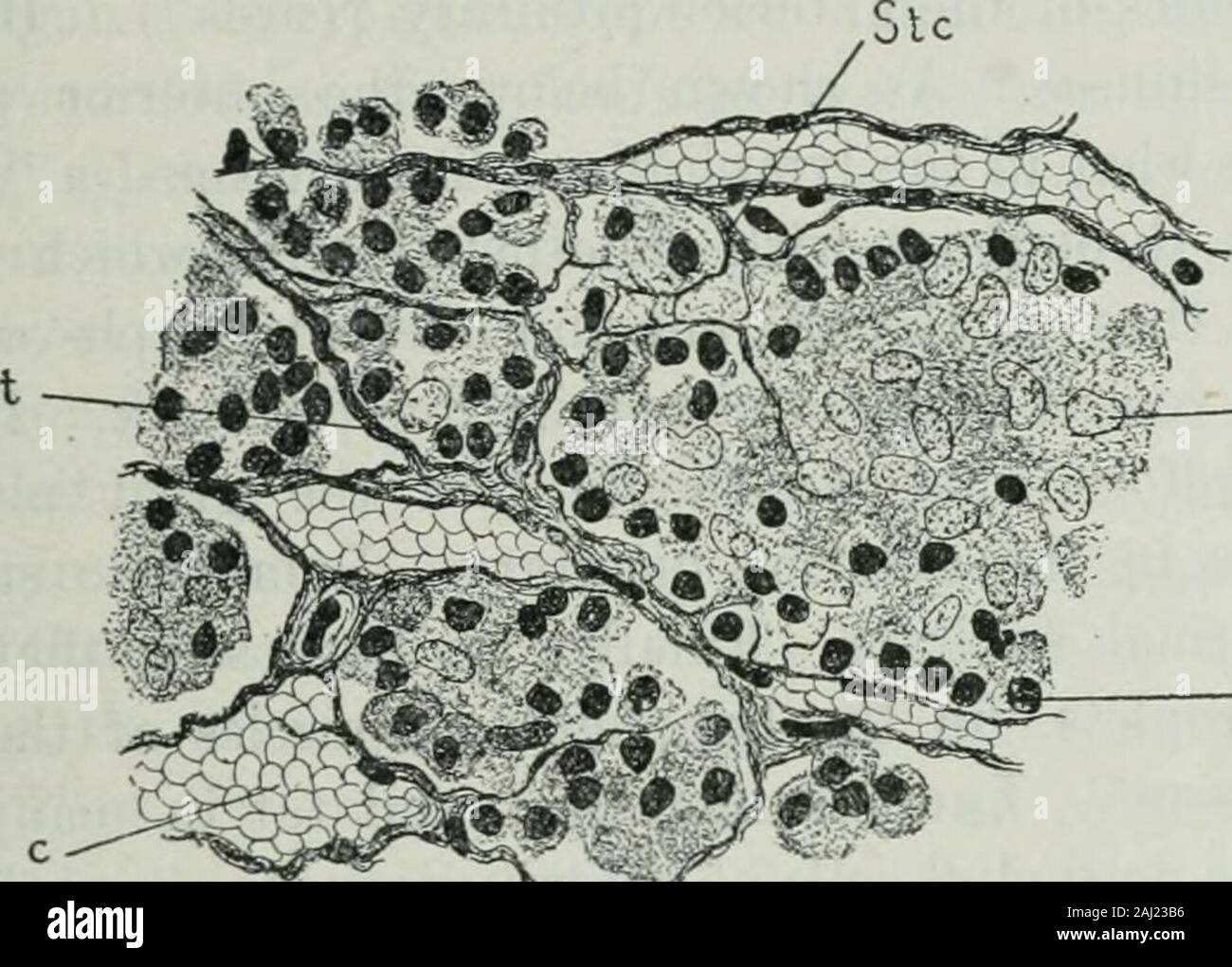 Le secrezioni interne e i principi della medicina . L'epitelio DF IL ANTERIDR PITUI-TARY ilS parzialmente CDMPDSEU DP FHACDCYTICEPITHELIDIU CELLULE, [S^jaus.] Fig, 1, EpitHBllold cBlls in un tubercolare ghiandola linfatica un.llolfcfeUs f! ^ ° *^^ la ghiandola pituitaria. Phagccytic: epltha- 4 leucociti come distributori di veleni e rimedi. 1041 anche se qui e là disposte in ordine a causa della con-tiguity delle loro pareti tubolari o dello stroma, sono ammassato .promiscu-ously. Questo è chiaro nuide dal taglio di seguito riprodotta da apaper da Launois e Mulon,^^ che mostra secondo theirdescription, sideroph Foto Stock