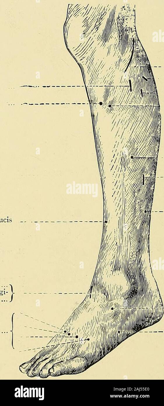 Un manuale pratico di elettricità medica : i raggi röntgen e Finsen luce . M. tensor fasciali lat. (Ham.N. cruralis.) M. rectus femor. M. vastus extern.Tsl. vastus extern. Fig. 107.-motore di punti della superficie anteriore della coscia(Ziemssen). 14 210 un manuale pratico di elettricità medica i muscoli possono essere superexcitable e i nervi sub-eccitabili, ecc. (A) Faradic Superexcitability. Il faradic cambiamenti quantitativi sono di gran lunga più difficile il manometro a sono il galvanico, perché esiste in Peroneus longus ...tibiale anticus ... Estensore hallucis longus Ant. nerveExtensor tibiale brevis di Foto Stock