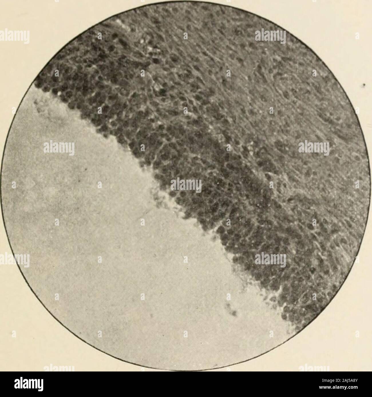 Il Hahnemannian mensile . La stagionatura ovulo vicino alla superficie dell'ovaio, mostrando la membrana granulosa. Moltiplicato 150 volte. Fig. Spesso strato di cellule ghiandolari sulle pareti di un cistica follicolo di Graaf.moltiplicato per 200 volte. Fig. 4. Foto Stock