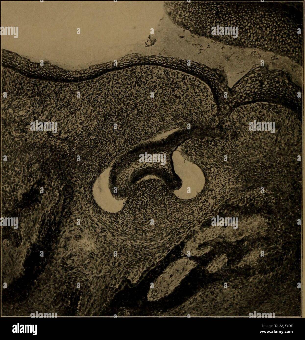 Un libro di testo di dental Istologia ed embriologia, comprese le direzioni di laboratorio . Una sezione attraverso l'arcata mandibolare: E, smalto organo; d inizio della papilla thedental; B, osso; F, piega dal lato della mandibola alla base della copertura thetongue l inizio della ghiandola sublinguale; T, la linguetta. tunica esterna o lungo la corda un bocciolo di cellule epiteliali growsout e ruota verso il basso nel mesoderma, passando sopra thefollicle parete (Fig. 283). Questo continua a crescere downwarduntil ha raggiunto la posizione al di sotto e a lingualof il germe del dente per dente temporaneo, dove developsinto t Foto Stock