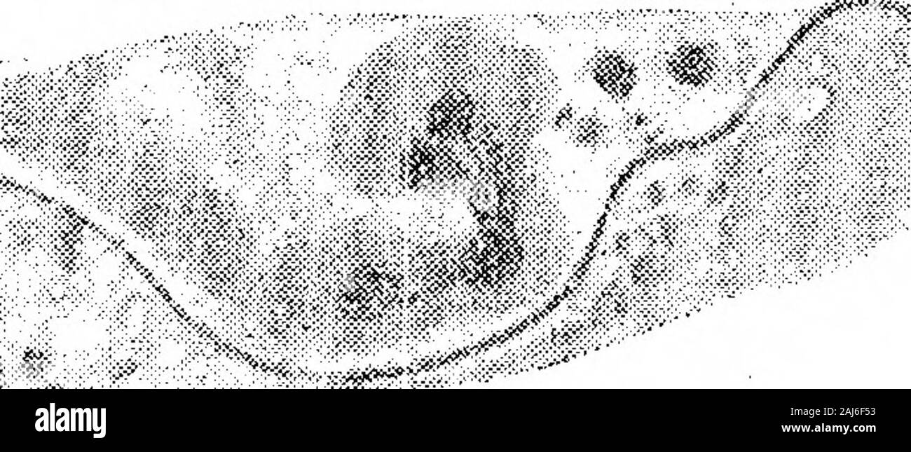 Ulteriori ricerche sullo sviluppo di Trypanosoma gambiense in Glossina palpalis . 4-2 ? / ^?^ X 2000. Fig. ^d.- Trypanosoma gamUense da hind-gut, dieci giorni dopo il mangime infetto. La Fia. 40.-T. gamhiense da fore-gut, 17 giorni dopo mangimi infetti. Fig. 41.-T. gamhiense da fore-gut, 17 giorni dopo mangimi infetti. Fig. 42.-7^. gamhiense da hind-gut, 34 giorni dopo mangimi infetti. Fig. 43.-^. gamhiense da metà-gut, 34 giorni dopo mangimi infetti. Fig. 44.-:r. gamhiense da hind-gut, 46 giorni dopo mangimi infetti. Figg. 39-44 rappresentano ciò che ci sembrano forme degenerative del normalreproducti Foto Stock