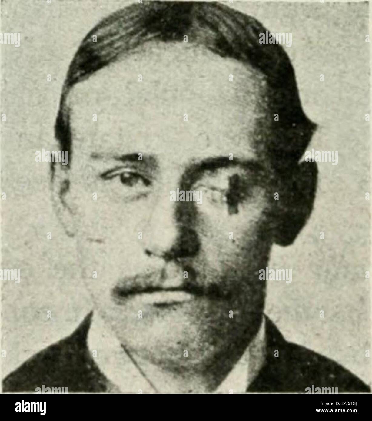 Il nessuno le malattie dell'occhio : come rilevare e come trattare con loro . Il bendaggio triangolare. si estende a partire dalla estremità nasale di numero oneobliquely verso il basso e verso l'esterno lungo il lato. Coperchio chiuso con colla di pesce intonaco. del naso, mentre il terzo si unisce il tempoi ilextremity alla estremità inferiore del secondo sti p RIMEDI IN PRATICA oftalmica 475 sulla guancia. Queste strisce adesive thedressings tenere saldamente in posizione. A differenza di altre band- Foto Stock