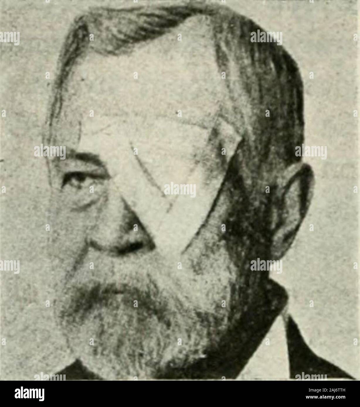 Il nessuno le malattie dell'occhio : come rilevare e come trattare con loro . fthese procedure è desiderabile in considerazione della thedepressing effetti sulla maggior parte dei pazienti. Come ruleabstinence da tutte le forme di lavoro vicino a com binata con una vita all'aperto, risponde la demandsof la maggioranza dei casi. Occhiali protettivi, occhiali, eye-sfumature, medicazioni e bendaggi sono usati per guardagainst tali influenze esterne (materia infettante,vento, polveri, forte artificiale o naturale si accende,il fumo) suscettibili di irritare un infiammato orcongested occhio, o uno che è stato ferito oroperated su. Il bendaggio triangolare è la su Foto Stock