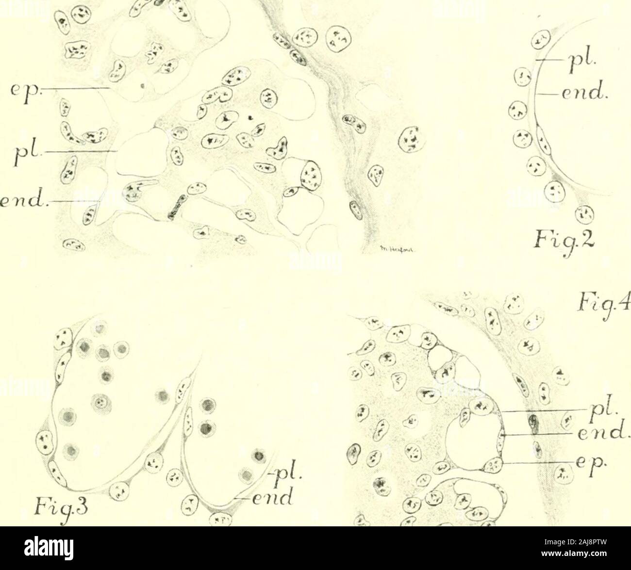 Il giornale americano di anatomia . ty, e la cellula l)odies, come in EP. Su questo confine tra il gruppopiastre. In corrispondenza di estremità. La piastra e l'endotelio sottostante sono distinte.X 640 diametri. 2 e 3 porzioni di immaturi glomeruli mesonephric da un essere umano em-bryo di circa 10 mm. (Keibel, n. 149,5.) per mostrare lo sviluppo di epithelialplates e corpi cellulari. X circa 640 diametri. 4 Porzione di glomerulus renale del feto di gatto di 8..5 cm. Orientamento come infigura 1. Piastre epiteliali già presente. X 640 diametri. 6 Parte del labirinto di placenta di un ral)bit di 27 giorni, mostrando l'endo-thelium del Foto Stock