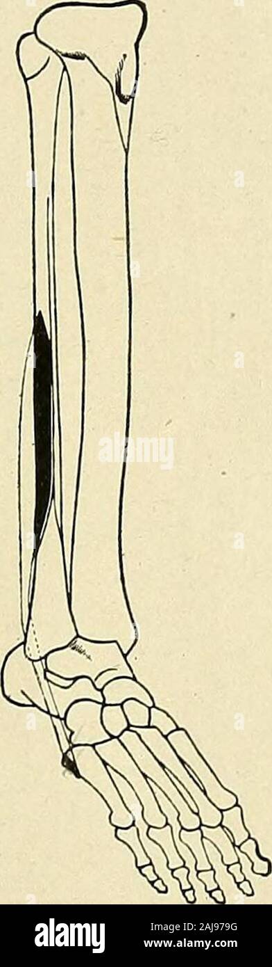 Un trattato di chirurgia ortopedica . Il diretto rapitori. Peroneus longus di destra ; delineare Peroneus brevis del lato destro ; contorno e le zone degli allegati. (Gerrish.) e aree di attacco. (Gerrish.) Extreme rapimento è raggiunto in atteggiamento di dorsalflexion, la sua estensione è di circa una metà che di adduzione; theentire gamma di movimento fra le due posizioni estreme essendo di circa 45 gradi. In questa descrizione il piede è considerato come un movimento su theleg, ma nell'atteggiamento di appoggiare il piede diventa il pointand fissa l'astragalo si muove su os calcis nel modo eper la posizione già Foto Stock