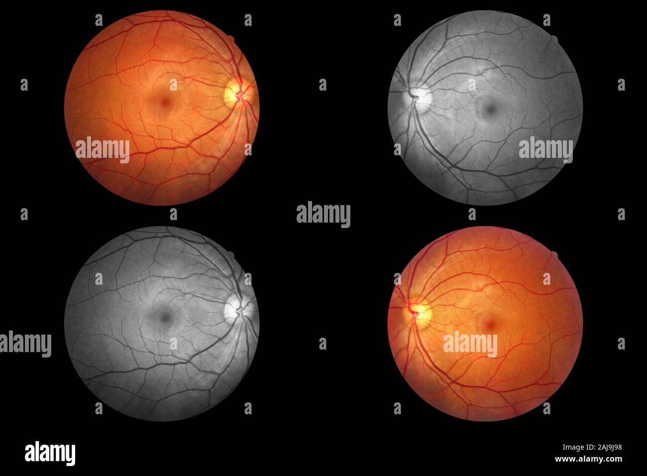 Occhio umano anatomia, retina, disco ottico arteria e vena ecc. Foto Stock
