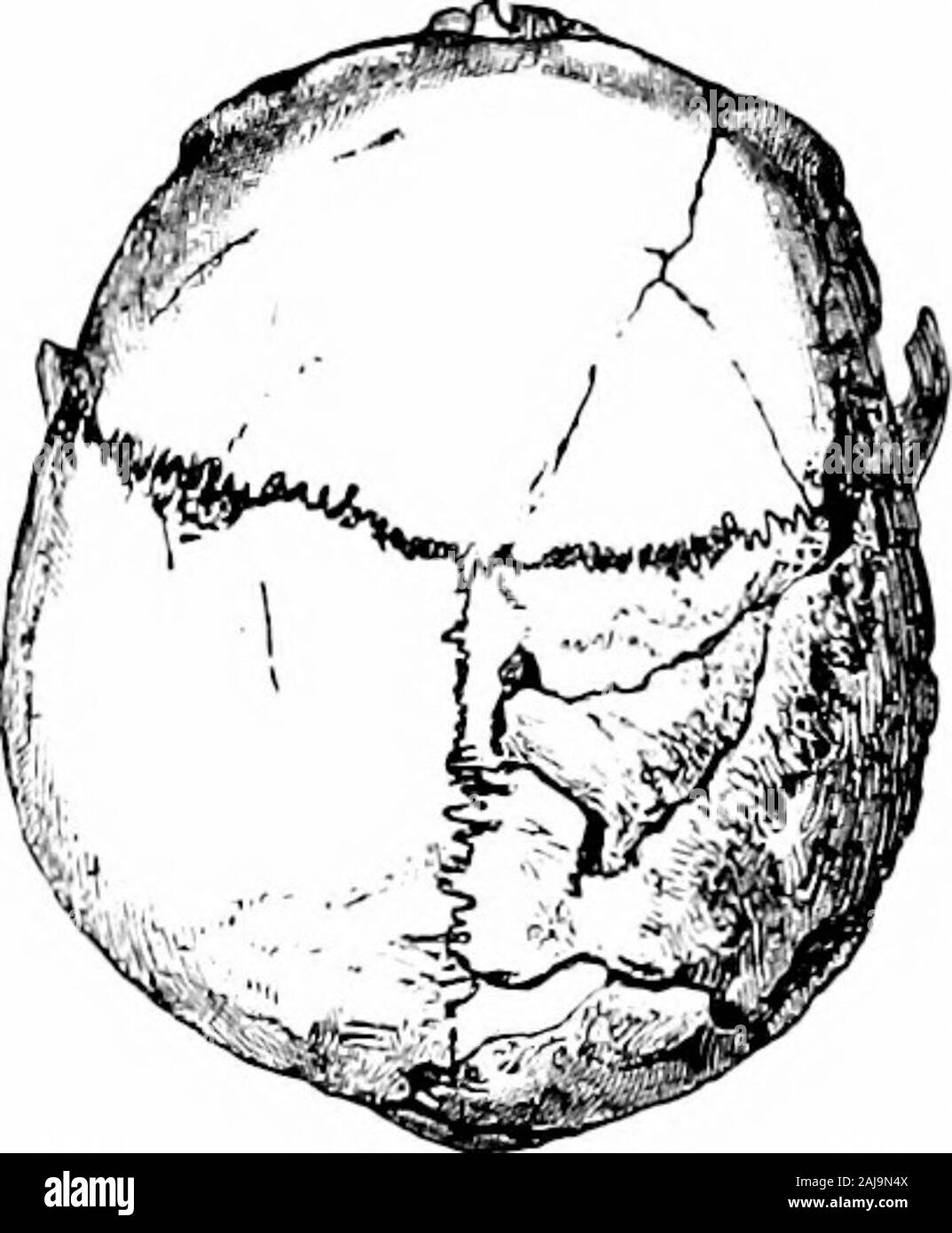 Una guida per l'antichità dell'età del bronzo nel dipartimento della British e antichità medievali . Fig. 2.-Braohycephalic cranio, Cowlam, E. E. Yorks cefalica.; il modulo intermedio chiamato mesaticephalic rangingbetween gli indici 75 e 80. Esso deve tuttavia essere remem bered-che la larghezza proporzionata del cranio è solo unadelle molte caratteristiche che distinguono i due tipi justexemplified; e i rispettivi scheletri stessi supportthe visualizza che il lungo e corto-guidato gli occupanti del PICTS E GAELS 21 round di tumuli appartenevano a varie gare. Per esempio,scheletri dal Foto Stock