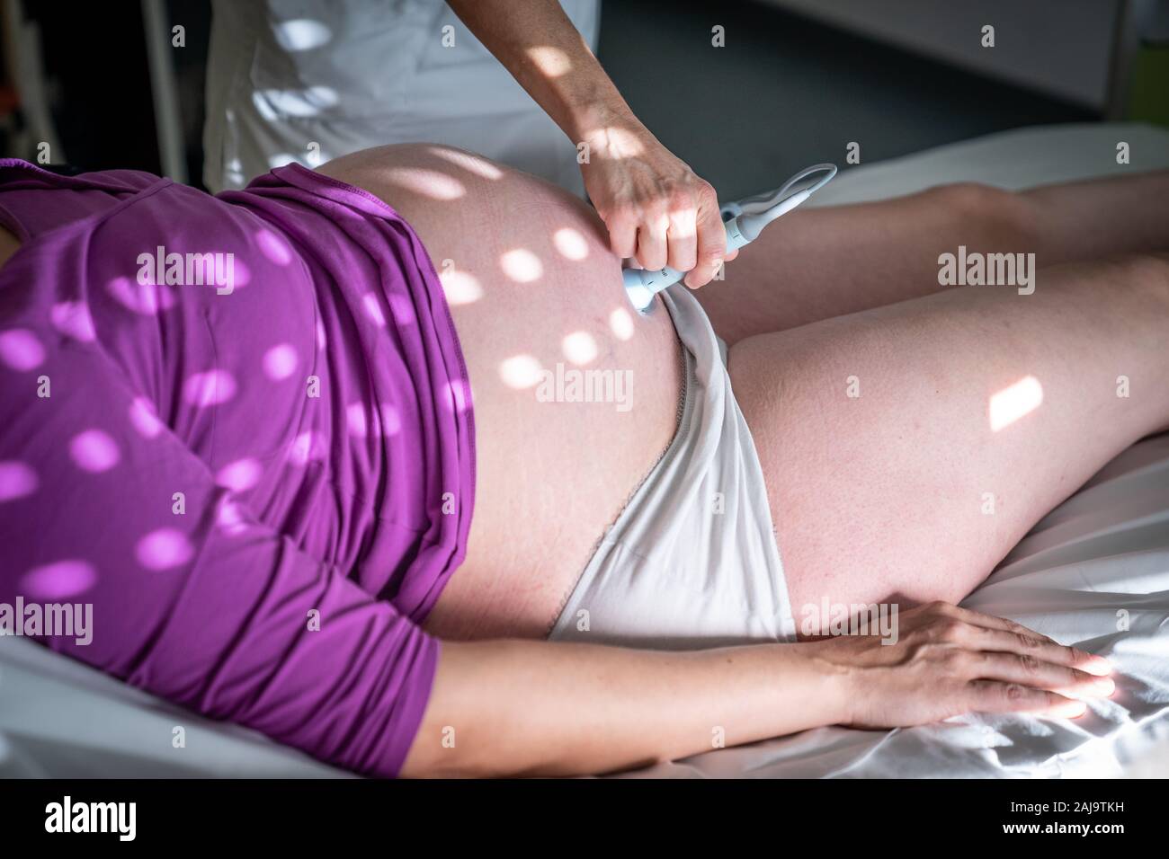 L'agopuntura pour femmes enceintes Foto Stock