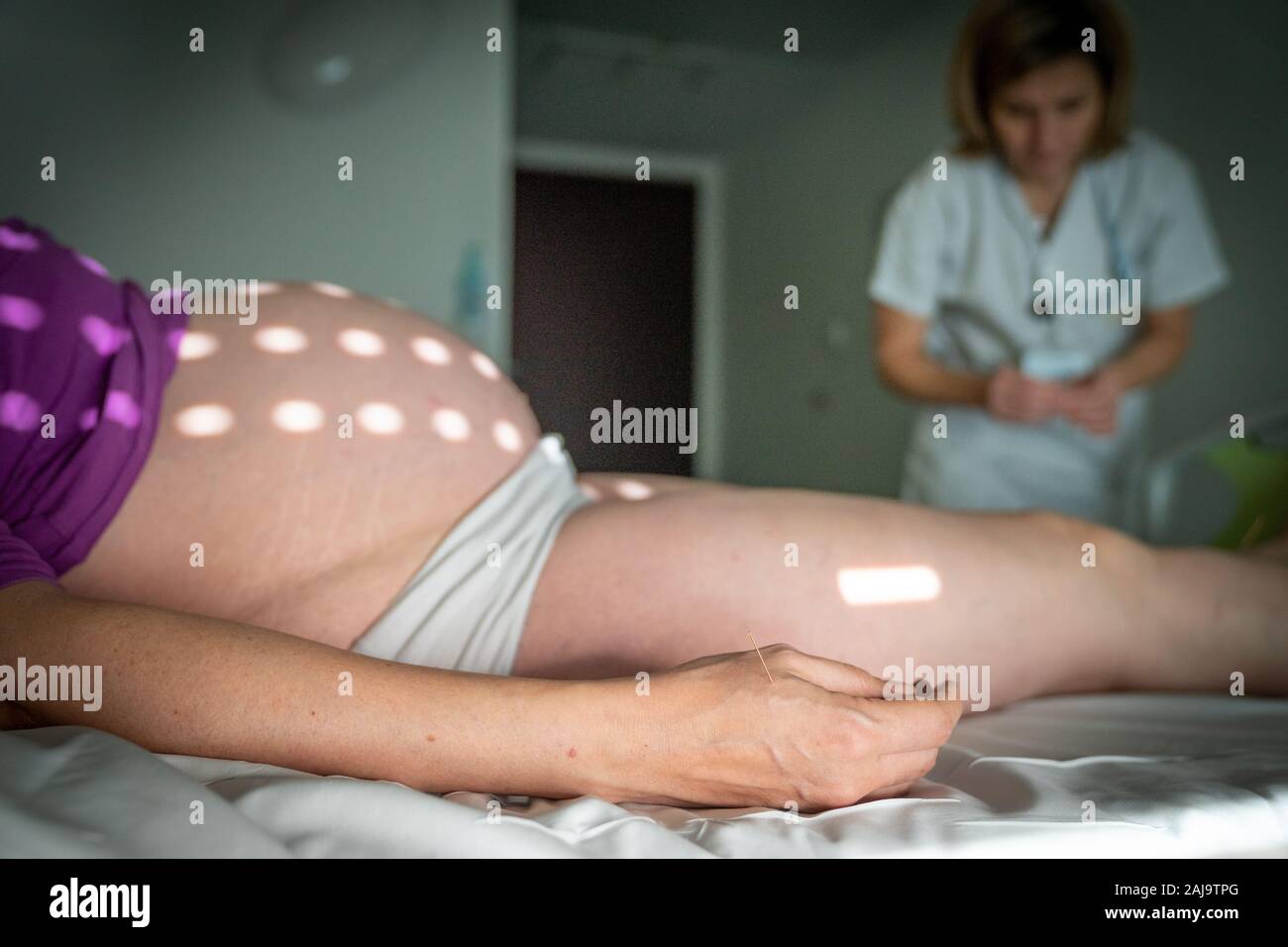 L'agopuntura pour femmes enceintes Foto Stock
