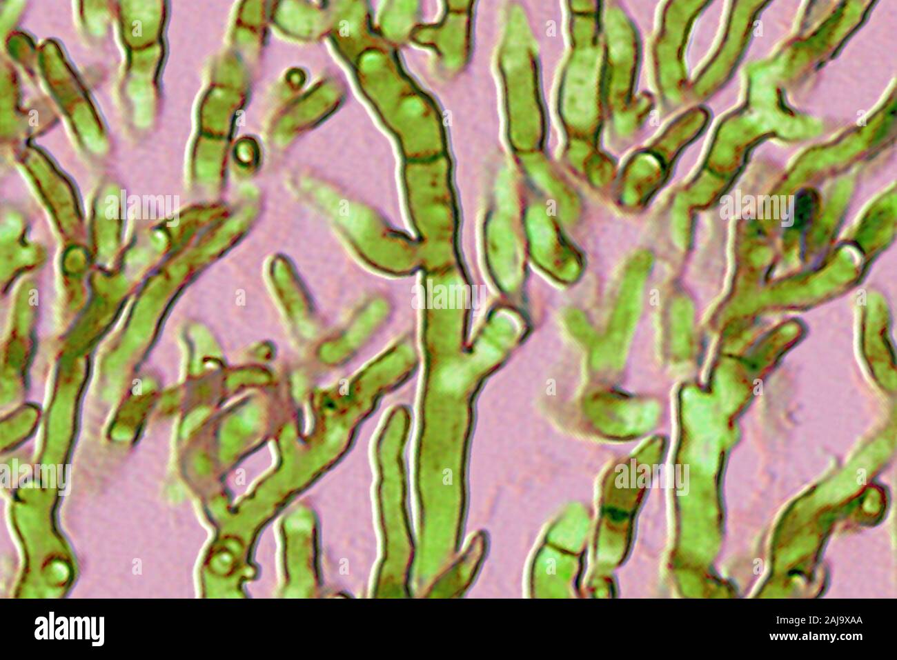 Aspergillus fumigatus Foto Stock