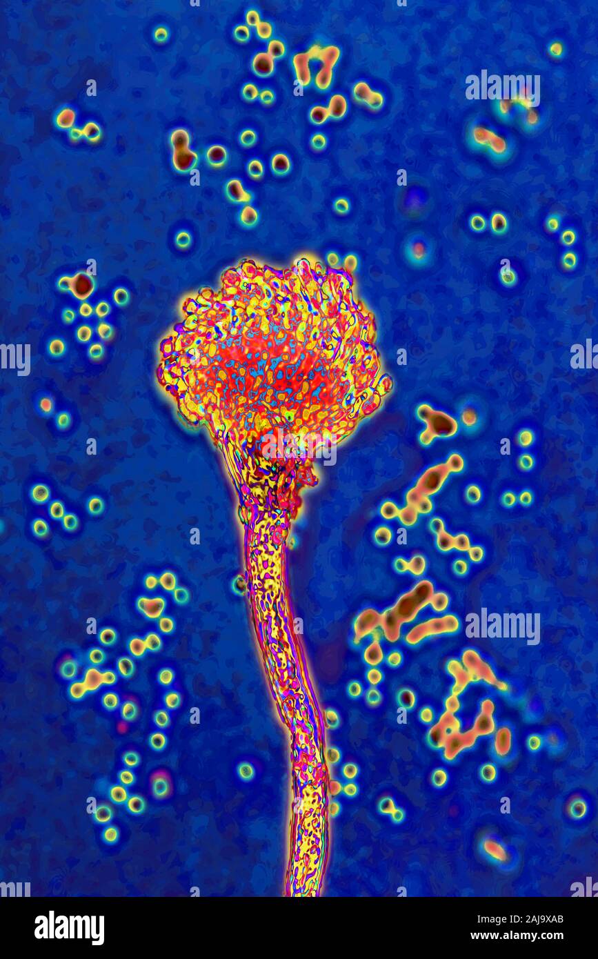 Aspergillus fumigatus Foto Stock