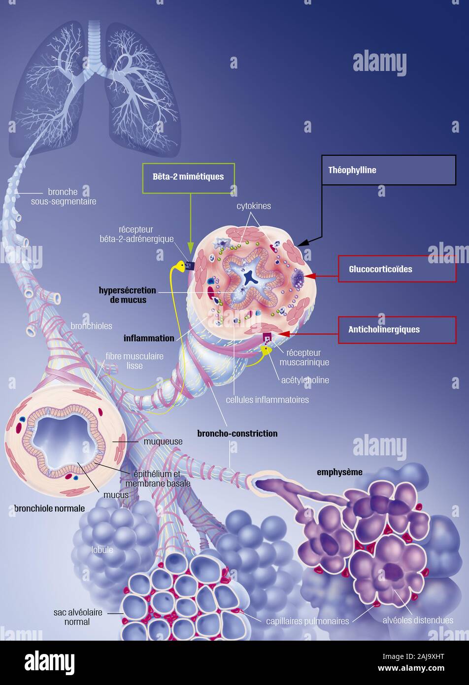 Copd Foto Stock