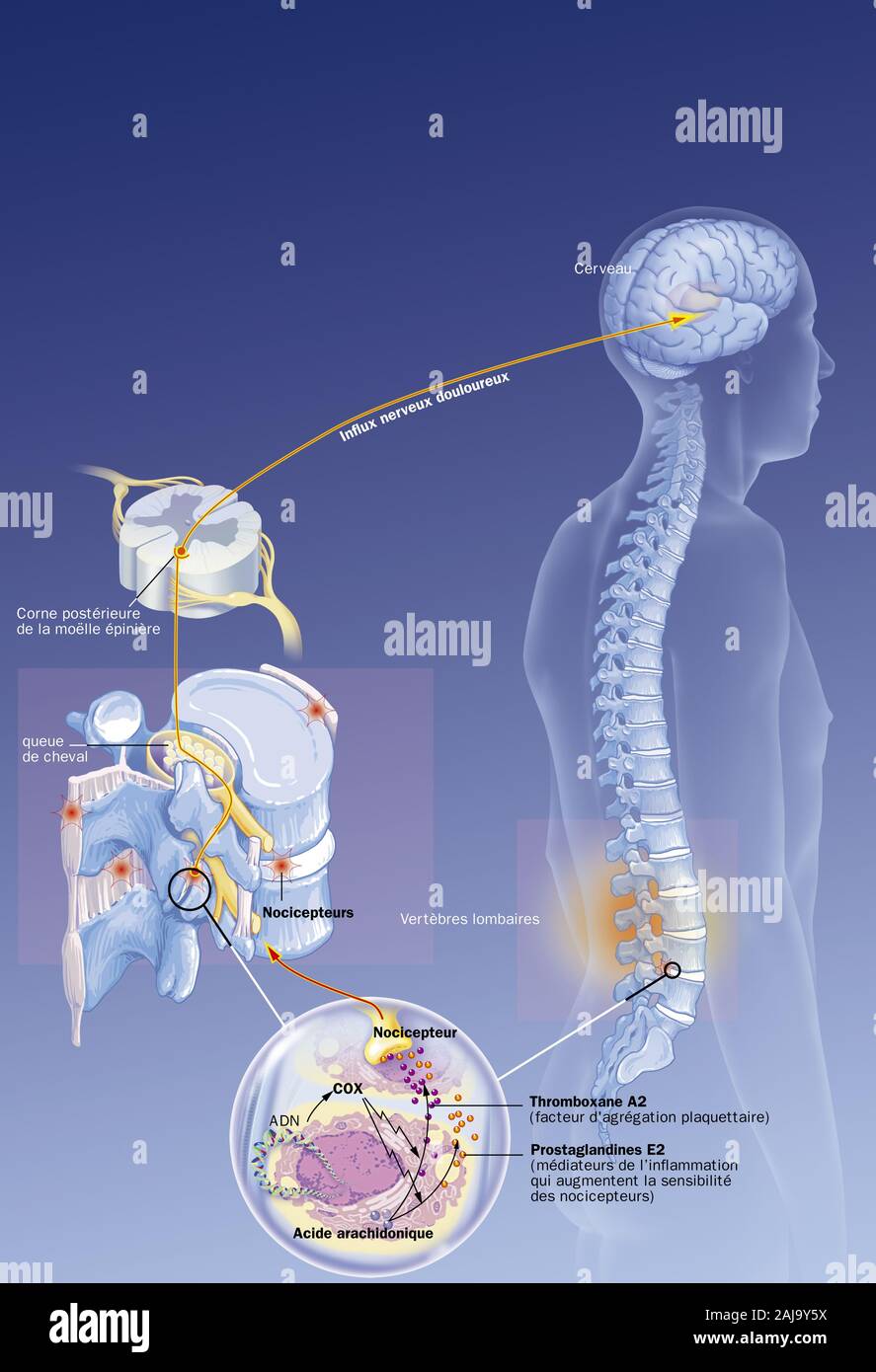 Cervello e colonna in situ, lombare nocicettori, gli impulsi nervosi, trattamento. Situazione anatomica di lombaggine su una silhouette. Sulla sinistra, dettagli del p Foto Stock