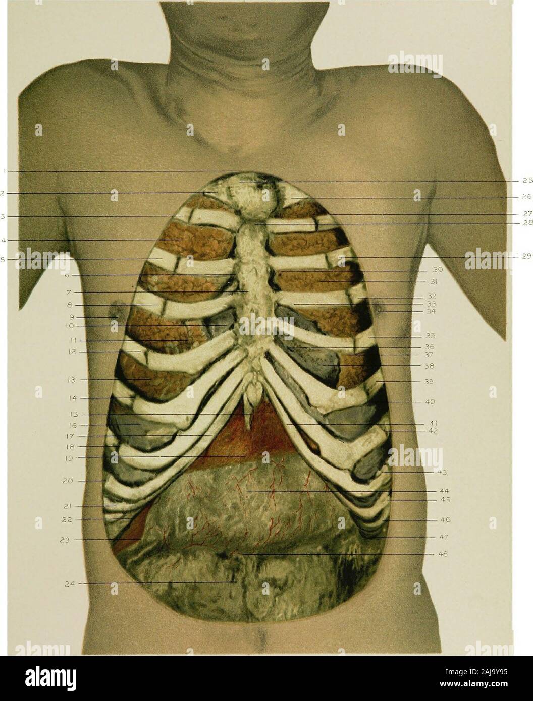 Anatomia regionale nella sua relazione alla medicina e chirurgia . e posizione delle valvole polmonari. 31. Il lobo superiore del polmone sinistro. 32. Sinistra quarta nervatura. 33. La posizione della valvola mitrale. 34. Il nipplo di sinistra.36. Sinistra quinta costola. 36. Il ventricolo destro del cuore. 37. La posizione dell'apice battere nell'adulto. 88. La superficie superiore del diaframma, visto tra la quinta e la sesta nervature.S9. Sinistra sesta costola. 40. Il bordo inferiore del polmone sinistro. 41. La cartilagine della sinistra ottava costola, indipendentemente con- nesso con lo sterno. 42. Sinistra settima costola. 43. Sinistra ottavo ri Foto Stock