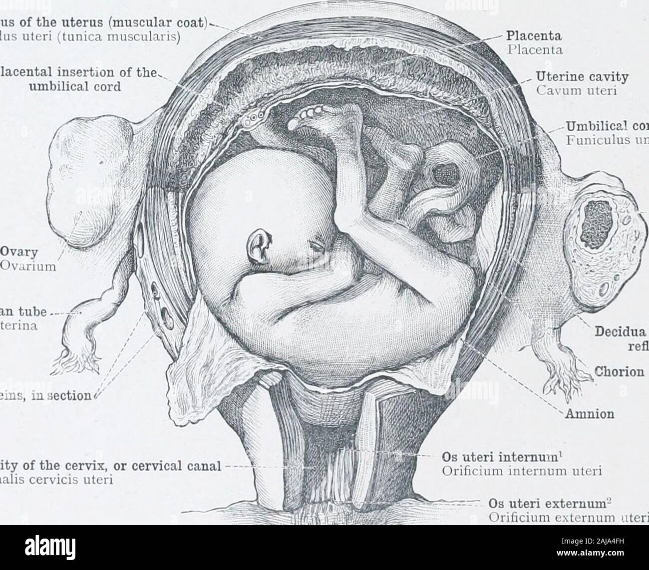 Un atlante di anatomia umana per gli studenti e i medici . Il sacco vitellino (vescicola ombelicale)Amnion tuba di Falloppio Tuba uterina (Falloppii) collo dell'utero o della cervice uterina uteri cavityCa um uteri embrione Os uteri internumOrificuim uteri internum cavità della cervice, o canale cervicale ( analis uteri cerMcis Os uteri extemum- Orificium uteri externum Fig. 890.-utero della quinta settimana di gravidanza, aperto da dietro. Dal reniov.il di parti delle membrane la cavità dell'amnion è stata aperta. Fondo dell'utero (rivestimento muscolare)uteri Fundus (tunica musculaiis) fa inserimento del.,u Foto Stock