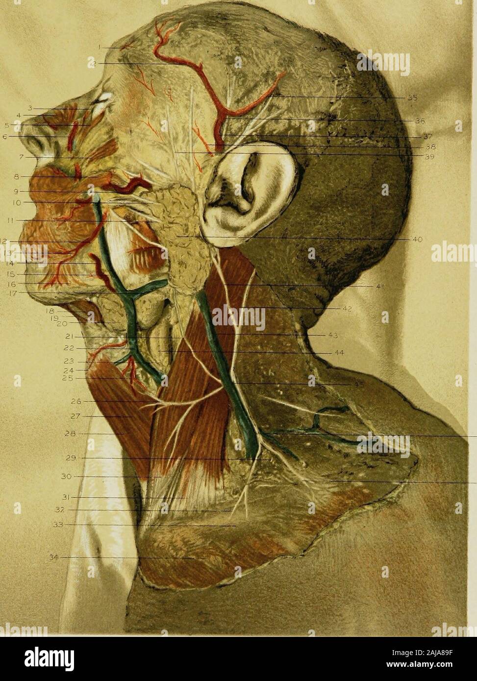Anatomia regionale nella sua relazione alla medicina e chirurgia . rami della superior arteria della tiroide. La superficialità trasversale nervi cervicale. Tlie sterno sinistro-muscolo della tiroide. Il leftsterno-hyoid muscolo. La fascia al di sopra del sovra-clavicular fossa, Tlie porzione sternale dell'sterno-cleido-muscolo mastoide. La porzione clavicular della sterno-cleido-muscolo mastoide.sternale clavicular e nervi, dal plesso cervicale di nervi.Lo scudo sopra la clavicola.La fascia al di sopra del grande muscolo pettorale.I temporali superficiali nervi.Il auriculo-nervo temporale.L'arteria temporale. L'orbitale Foto Stock