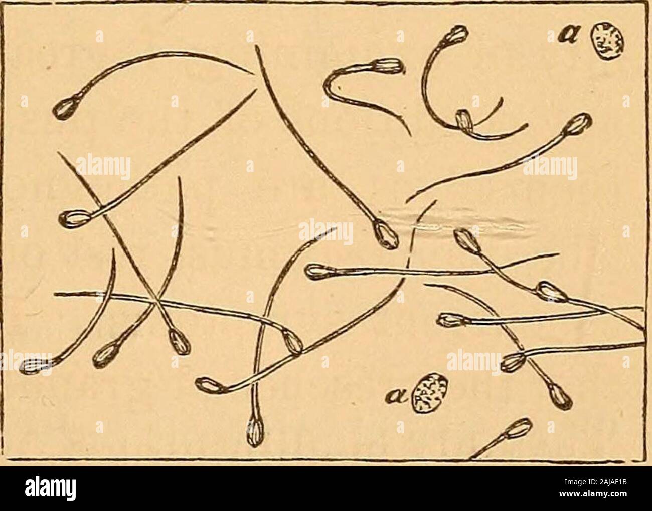 Malattie renali : una guida clinica per la loro diagnosi e trattamento .  Sperma-tozoa. Gli spermatozoi.--l'unica importanza della fotocellula di  germi spermatico nell'urina,in relazione alle malattie del rene, restson il  fatto che