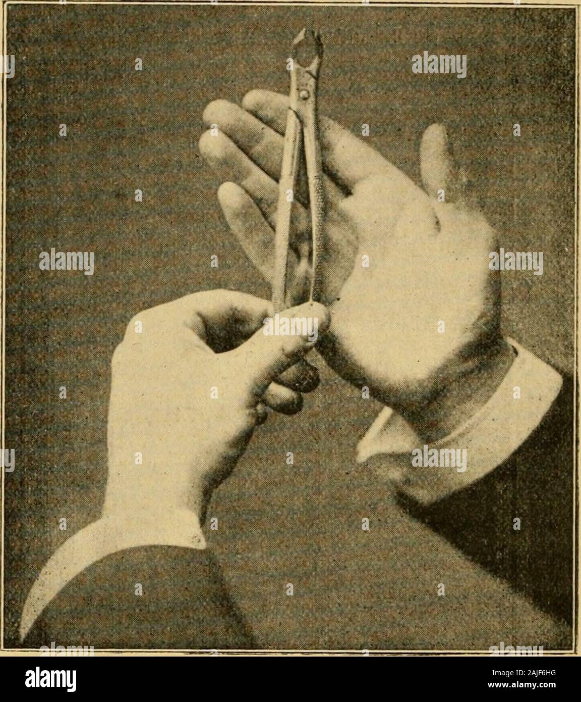 In estrazione, con note di anatomia e fisiologia, dei denti, per studenti di medicina . aumento,in un caso la tua potenza di sollevamento e di trazione otheryour downw^ARDS. Di nuovo, i pazienti headniust essere mantenuto costante. Questo viene fatto usando thefingers della mano sinistra che deve egli ha posto accord-ing al dente particolare che si sta per rimuovere.Nel caso di rimozione di denti inferiori, minore jawshould essere premuto quanto più basso possibile e in casodi dentatura superiore della testa deve essere gettato indietro. Prima di passare alla considerazione del modo ofextraction di ciascun dente individualmente Foto Stock