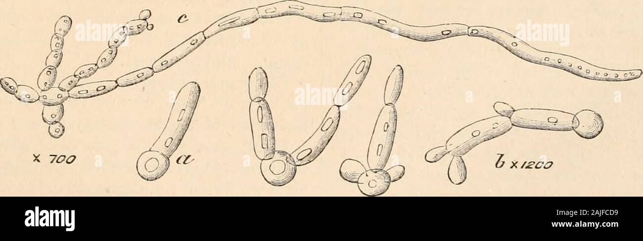 Hardwicke di scienza-gossip : Un mezzo illustrato di interscambio e di scandalo per gli studenti e per gli amanti della natura . Fig. 17.-5. apiculatus. X circa 500.. X 700 Fig. 14.-5. albicans; un inizio di crescita ; b, più avanzati ; c, formazione di micelio. (Dopo Grawitz.) formazioni a cui stiamo alludendo aveva theirorigin semplicemente nella disattenzione dell'experimenter,o nell'inadeguatezza dei mezzi adottati forsecuring una coltura pura. Il Saccharomycetesare come effettivamente autonomi come qualsiasi altro funghi.-Tr.] 71. S. ellipsoideus, Reess. Cellule ellittiche, prevalentemente 6 /x lungo, isolato o unitedin Httle b Foto Stock