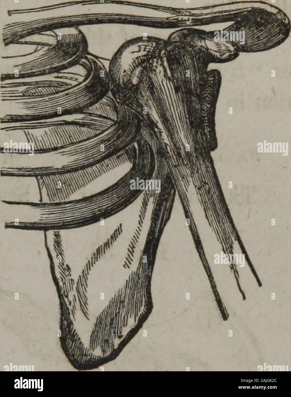 La pratica omeopatica di chirurgia : insieme con intervento chirurgico . tempo; e ashe ostinatamente rifiutato di prendere altre medicine per lo scopo ofbringing circa il rilassamento, - gli diede una pinta di whiskey atonce, e presto si era lui ubriaco.* In tale stato, pro-ceeded alla riduzione e presto effettuato, senza la minima dif-ficulty, o il paziente dando alcun segno di dolore. Visitando himthe giorno successivo, riuscì in una ancora migliore funzionamento, - himof indurito di una malattia peggiore : egli lo persuase a firmare il pegno, whichhe ha fedelmente mantenuta. Avanti lussazione - sotto la clavicola. La sym Foto Stock