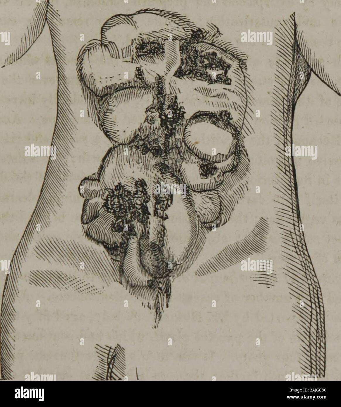 La pratica omeopatica di chirurgia : insieme con intervento chirurgico . se, condizione che possiamo discoversome regola per la sua sicura e appropriata dell'occupazione. L'indi-zione per l uso di questo articolo e il motivo per cui molti dei cerotti thesecancer sono cadute in discredito, dopo aver notato performedrepeated cure, è che l'arsenico è stata talvolta ab-assorbito ed ha prodotto i suoi effetti velenosi. Il giallo di arsenico (solfuro, orpimento) sembra avere beenmore generalmente utile rispetto alla arsenious acido. È il principalremedy in uno o due ricette di cancro che hanno avuto molto successo-ful. Abbiamo Foto Stock