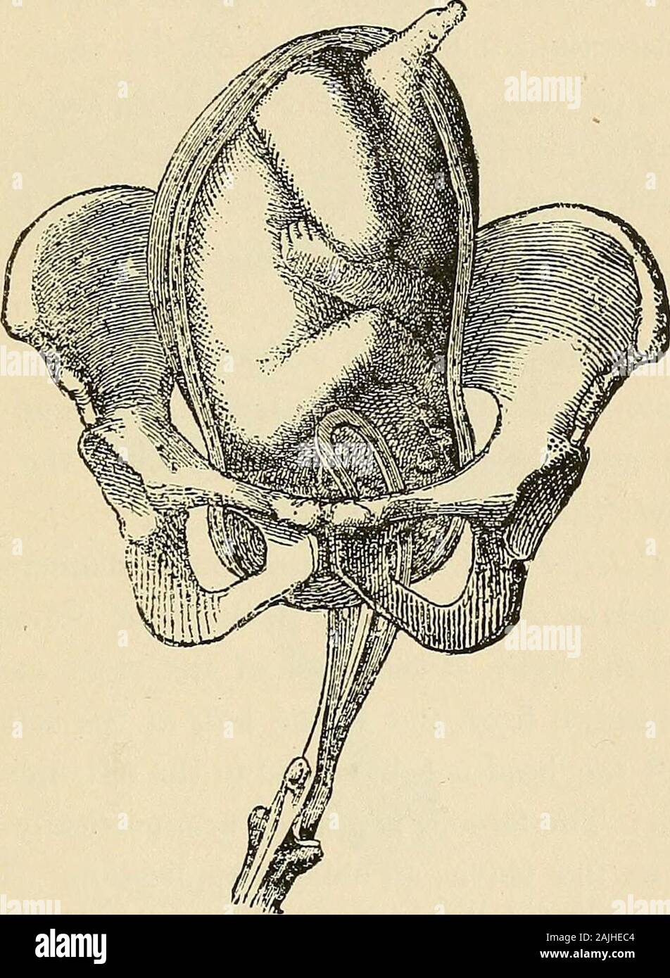Encyclopaedia - Wikizionario di ostetricia e ginecologia . , Inserito prima, iscarried al lato destro della testa tlie, dietro e a destra. Il leftblade è inserito e la seconda a sinistra e portato da dietro in avanti,all'estremità anteriore di sinistra diametro obliquo del bacino, cheè, sul lato sinistro della testa, nella parte anteriore e a sinistra, dopo Mme. La-chapelles metodo. Quando è bloccato, minore è la curva attraversa l'occipite,e punti alla coscia destra della madre. In un primo momento la trazione è realizzato il forcipe. 123 verso il basso e non appena la testa raggiunge il pavimento pelvico è rotatedfrom diritto a l Foto Stock