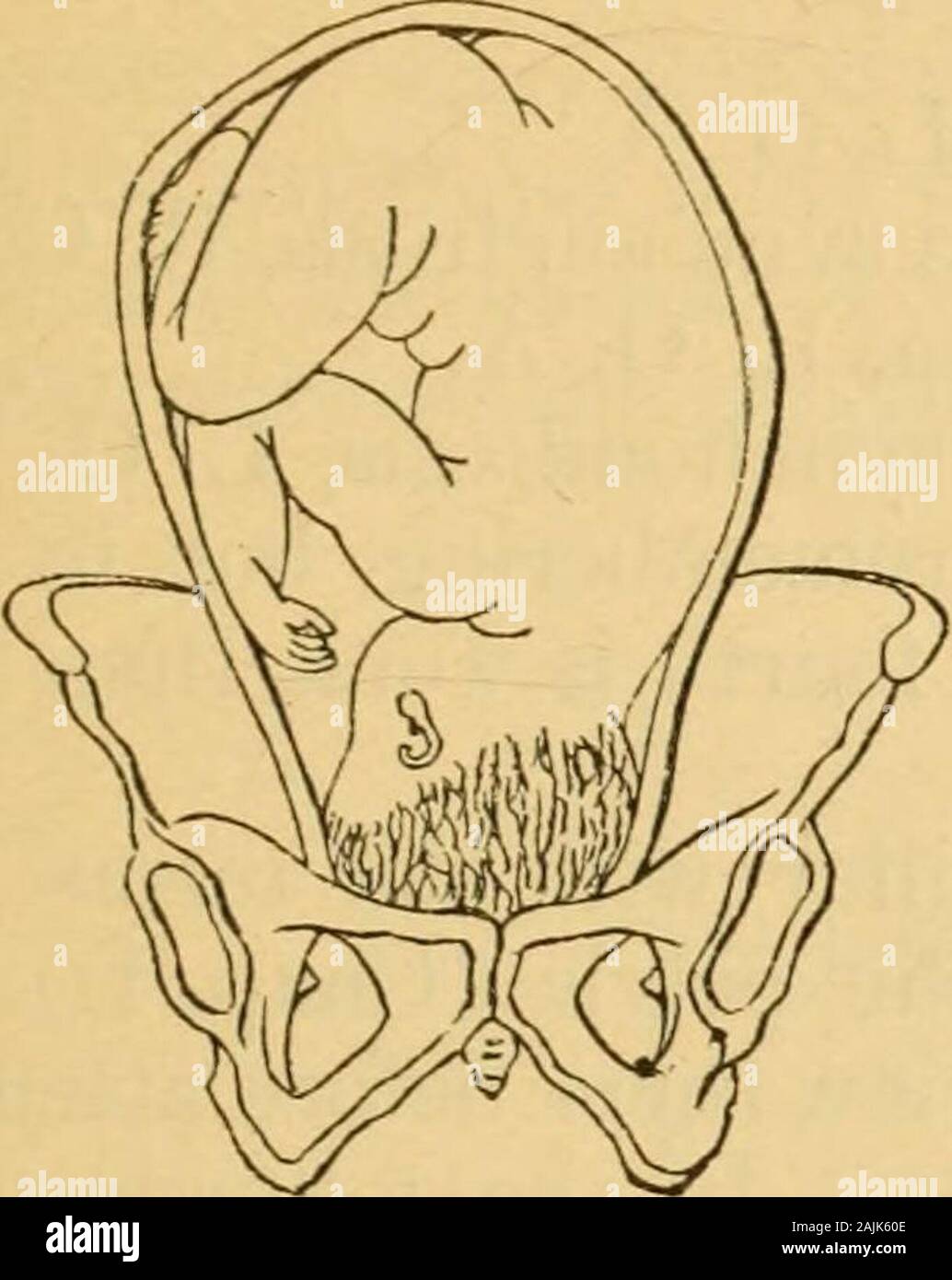 Un manuale pratico di ostetricia . ing parte, e alcuni altri punti dati su thepelvis. In presentazioni di testa l'occipite è il dato punto sullato presentando una parte e i punti dati sul bacino sono idue acetabula, e due sacro-iliaca synchondroses. Così lequattro posizioni della prima presentazione sono: 1. Occipite a sinistra acetabolo (sinistra occipitoanterior).1 2. Occipite a destra acetabolo (destra occipitoanterior). 3. Occipite a sinistra sacro-iliaca synchondrosis (sinistra occipito-posteriore). 4. Occipite per diritto sacro-iliaca synchondrosis (destra occipito-posteriore). Molto raramente il occipite poi Foto Stock