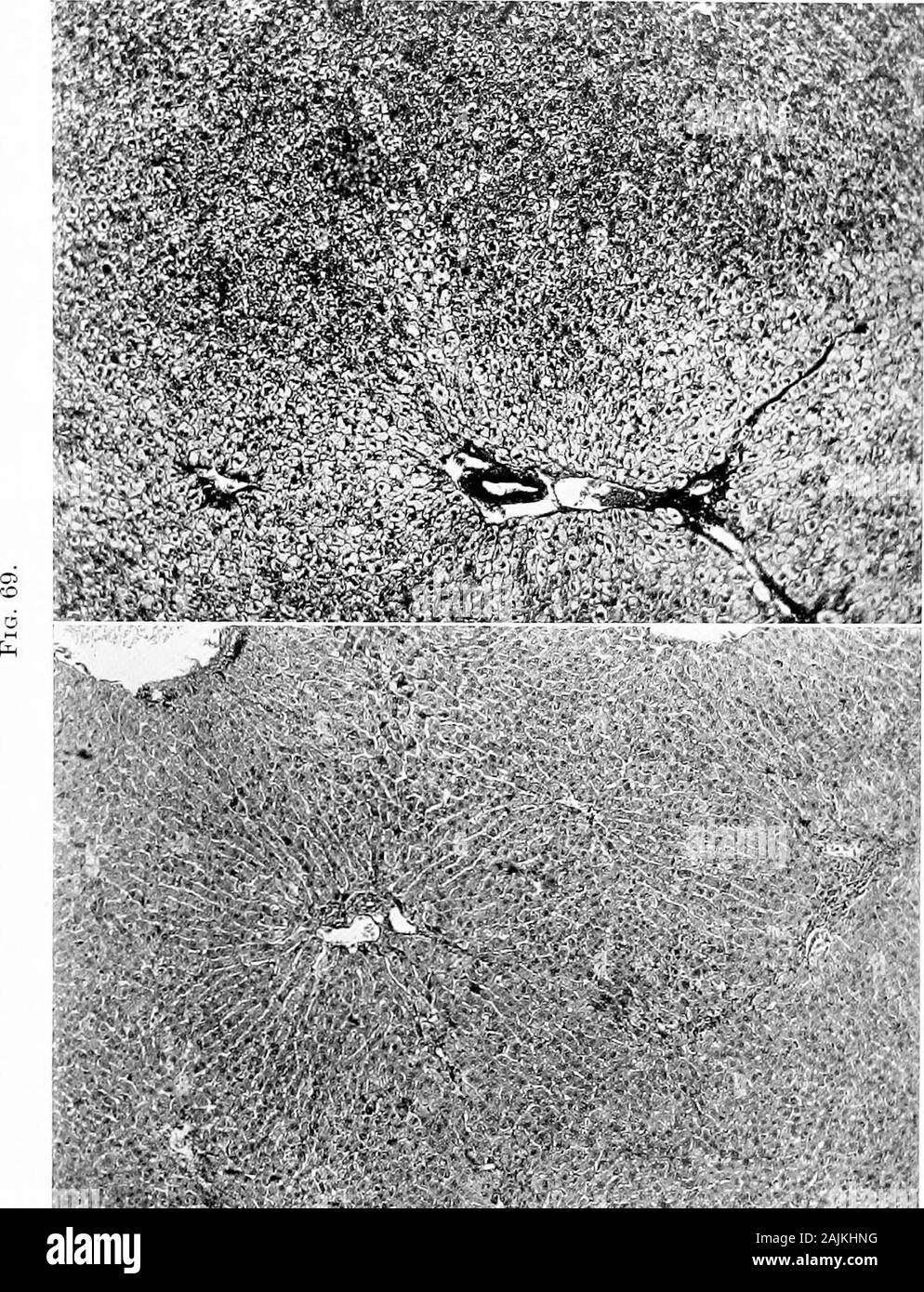 L'origine e la natura delle emozioni; varie carte hteenhours .. (2) Il anrount di glicogeno nel fegato è stata diminishedin tutti gli esperimenti che mostra brain-attività surrenalica; equando le variazioni istologiche sono state riparate, l'normalamount di glicogeno è stata nuovamente rilevato. (3) attraversato in pratica esperimenti werefound cambiamenti nella li^er dell'animale la cui Ijrain thestimulus ricevuto. Da queste premesse si deve considerare che il cervello, theadrenals e il fegato sono reciprocamente dipendenti l'uno dall'altro per la conversione di latente in energia cinetica. Eachis un organo vitale, ogni efjually Foto Stock