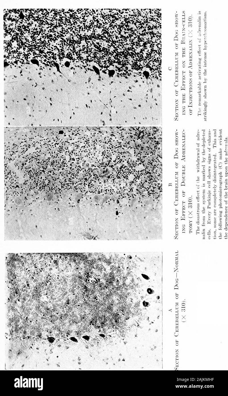 L'origine e la natura delle emozioni; varie carte . 2. Quando entrambe le ghiandole surrenali vengono escissi e nessun otherfactor viene introdotta la sostanza di Nissl progressivamente dis-appare dal cervello-cellule fino alla morte. Questo lontano-reachingpoint sarà l)e ripreso più tardi (Tig. Vai). Qui il nostro purjiose è quello di discutere la causa del cervello-cellchanges. Abbiamo visto che nel cervello incrociate e trauma bodycirculation provoca cambiamenti nelle cellule del brainwhich è scollegato dal corpo traumatizzato dalla itscirculation, ma che è collegato con il traumatizedbf)dy dal sistema nervoso. Abbiamo visto che Foto Stock