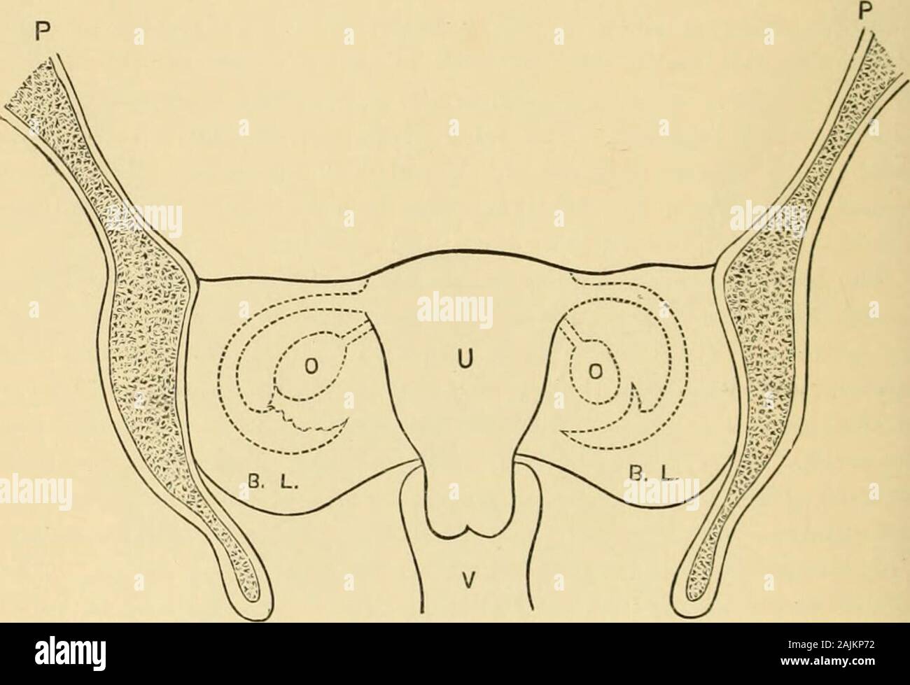 Un sistema di ginecologia . ed in modo tale che le loro superfici anteriori lookdownward e in avanti. La base di ciascun legamento sarà representedapproximately da una linea ondulata, convessa sulla sua metà esterna, disegnato 208 l'anatomia della femmina gli organi pelvici. dal bordo laterale del collo dell utero a livello di os internumoutward fino ad un punto appena per le trote del saero-iliae synchrondrosis (Fig. 09).Tts margine superiore, corrispondente a quella del tubo, è slightlyconcave vicino l'utero, dall'angolo superiore del quale si estende toa punto sulla linea pectineal, situato nella Vergine di circa Foto Stock