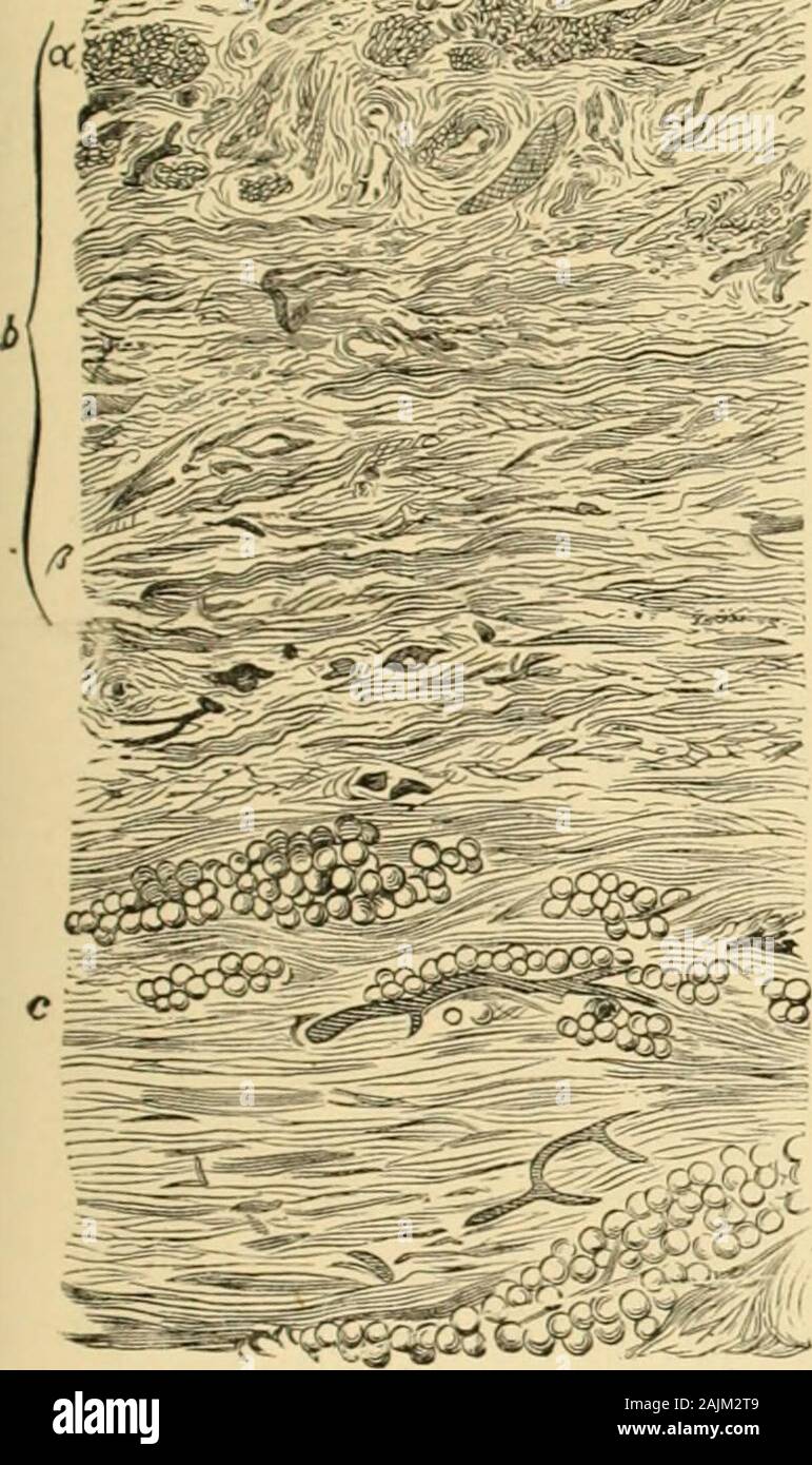 Un sistema di ginecologia . le; d, otturatore interno muscolo; c, e, psoasmuscle; /, linea alba Un sistema di ginecologia . le; d, otturatore interno muscolo; c, e, psoasmuscle; /, linea alba