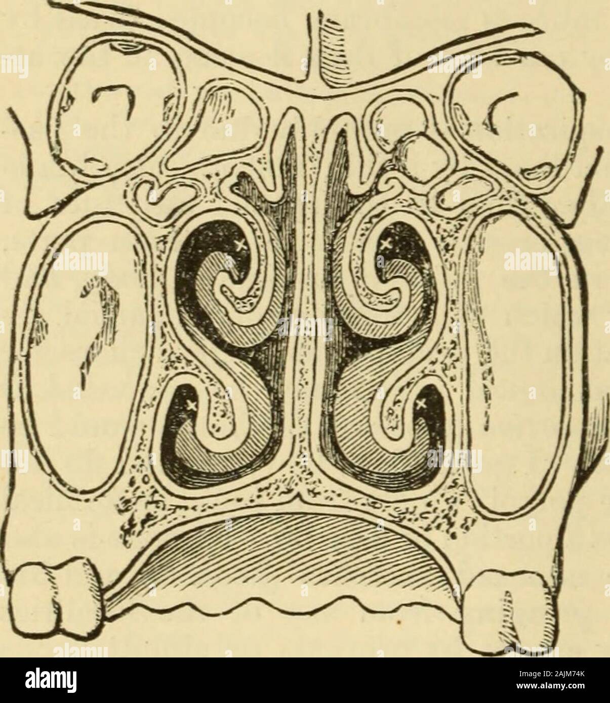 Un manuale di malattie del naso e della gola : compresa la faringe, la laringe, la trachea, l'esofago, naso e rinofaringe . , In modo universalmente praticata dai loro! 260 Malattie del naso e della gola. rispetto a quelle località è preso in considerazione. Questa vista è più oltre, ampiamente confermato dai recenti osservazioni di Zuckerkandl (p. 254)per quanto riguarda l'origine del polypi. Il ben noto a disposizione recurrenceof queste crescite, che è già stato sottolineato (vedere prognosi) isone delle grandi cause della difficoltà nel trattare con loro. Ora therecannot essere il minimo dubbio sul fatto che in alcuni casi Foto Stock