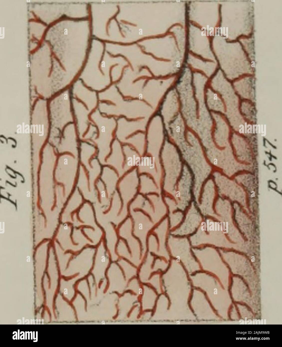 Elementi di anatomia patologica . e organi che questa texture serve toline. Si può infatti essere assunta come una proposta generale, che il colore oithe cappotto villosi dello stomaco e delle viscere è diverso nel bambino da whatit è nell'adulto; che è più profondo nella forte e robusto rispetto al weakand malaticcio ; e che essa è di diversi toni leggeri quando questi serbatoi areempty rispetto a quando sono distesi con il cibo. Nel feto e il bambino subito dopo la nascita il colore del rivestimento mucoso isof una luce rosa, intervallati da piccole macchie lattea ; nell'adulto, è più ofa biancastra appe Foto Stock