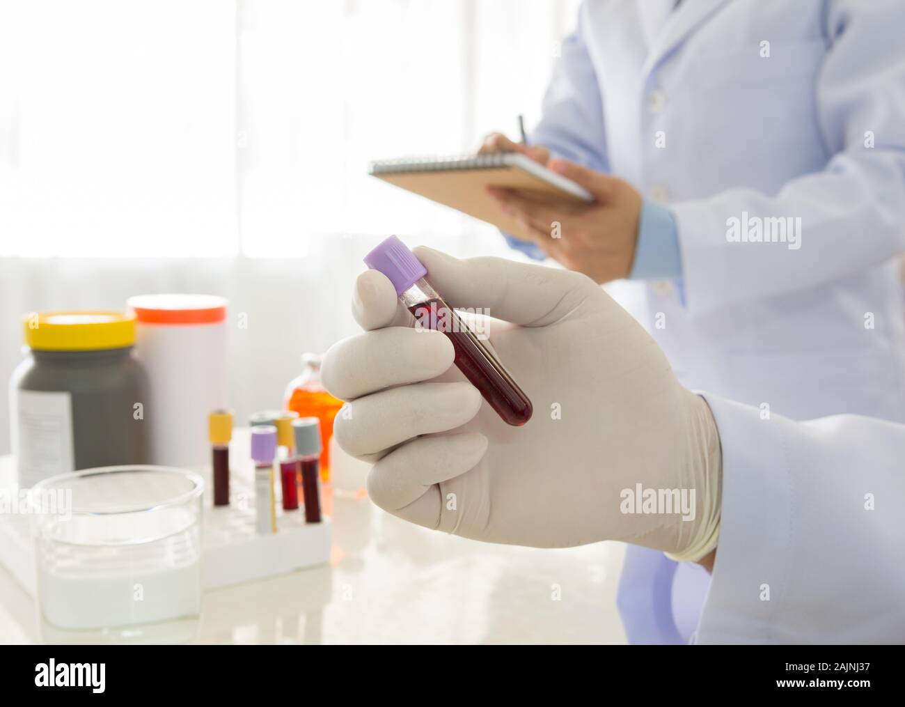 Medico tenendo una bottiglia del campione di sangue in laboratorio. scienza e concetto medico Foto Stock