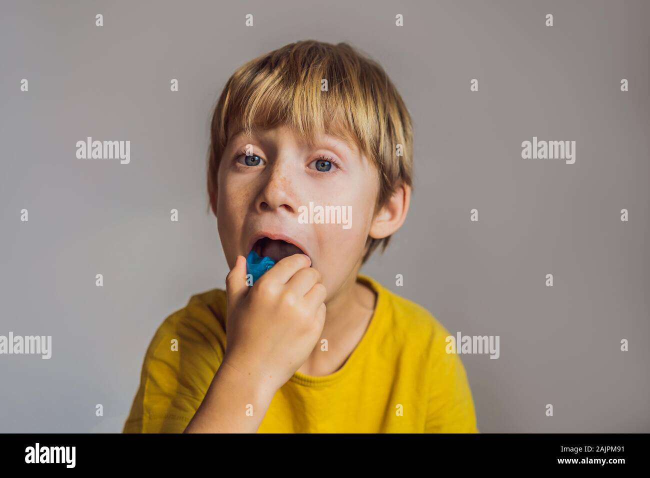 Sei anni di old boy mostra myofunctional trainer. Consente di equalizzare la crescente denti e morso corretto, sviluppare la respirazione bocca abitudine. Corregge la posizione Foto Stock