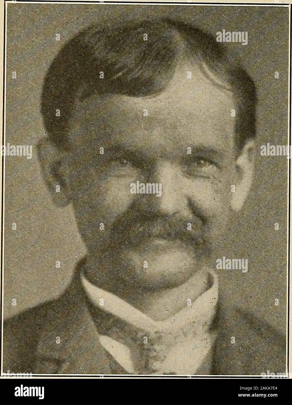 Malattie del sistema nervoso : un libro di testo di Neurologia e psichiatria . Il suo oggetto si alza presto, piena di schemesof di affari o di piacere. Egli fusses clamorosamente sulla casa, indifferentto il suo turbamento di altri popoli sonnecchia. Egli è molto impatientof ritardo, egli non può attendere un minuto per tutto ciò che egli vuole e se. Fig. 302.-l'espressione del viso di volo hypomanicwith di idee. &Gt; un libro di testo di pazzia, la Macmillan Co., 1914. Fase maniacale 635 non è imminente sull'istante egli jflies in una rabbia. Il courseof il post non è sufficientemente rapida per lui. Egli invia la sua lettersby tele Foto Stock