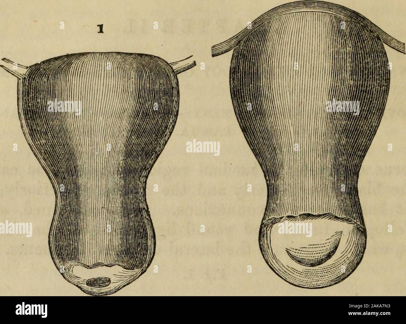 Una pratica sul trattato della infiammazione dell'utero, la sua cervice ed appendici : e il suo collegamento con la patologia uterina . urface dell'utero ècollegato con il retto, ma indirettamente, attraverso il mezzo di theperitoneum, che dopo la sua copertura e la regione superiore di thevagina, si riflette sul retto in modo da formare il posteriore o di utero-custodia rettale. La forma del collo dell utero è quello di una cava conoide, con la sua largeextremity, il corpo rivolta verso l'alto, e la sua piccola estremità, thecervix, verso il basso. Il collo dell'utero è divisa esternamente in tworegions, dall'inserimento o Foto Stock